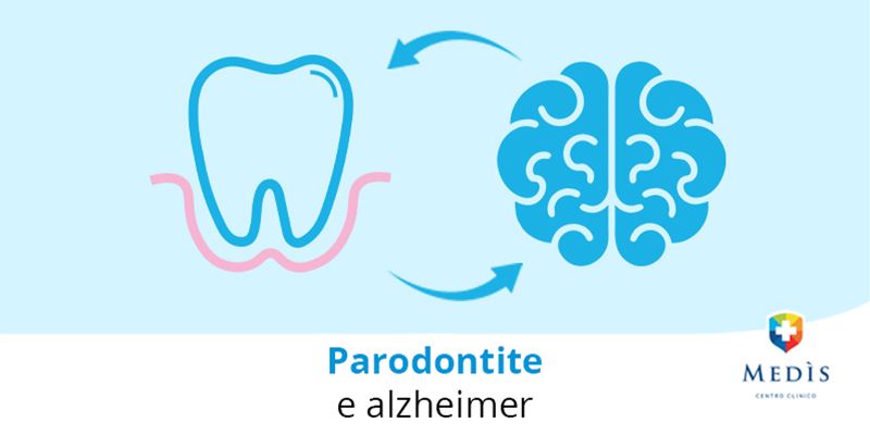 paradontite-e-alzheimer-blog
