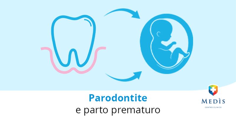 paradontite-e-parto-prematuro-copertina