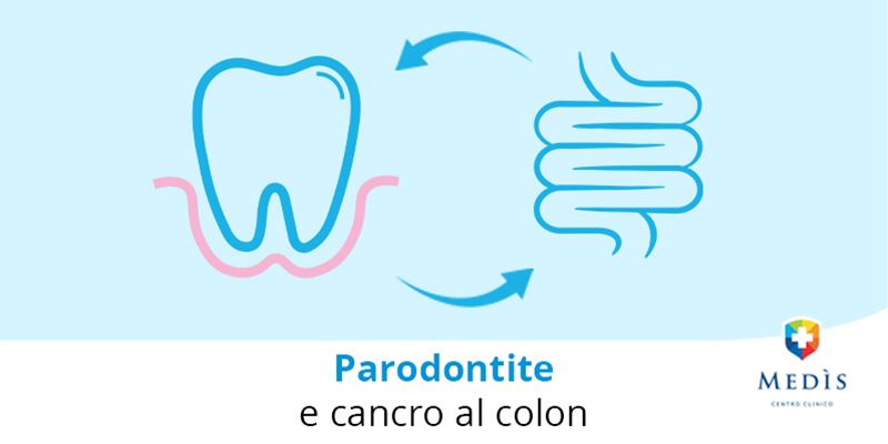 paradontite-e-tumore-al-colon-blog