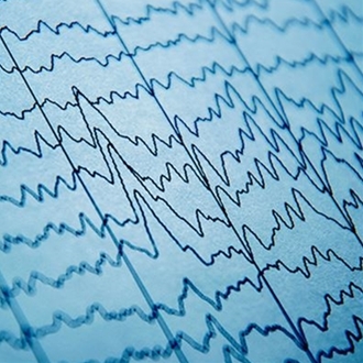 EEG – Elettroencefalogramma: cos´è e perché viene richiesto?