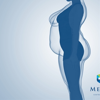 Obesità: capirla davvero per affrontarla meglio